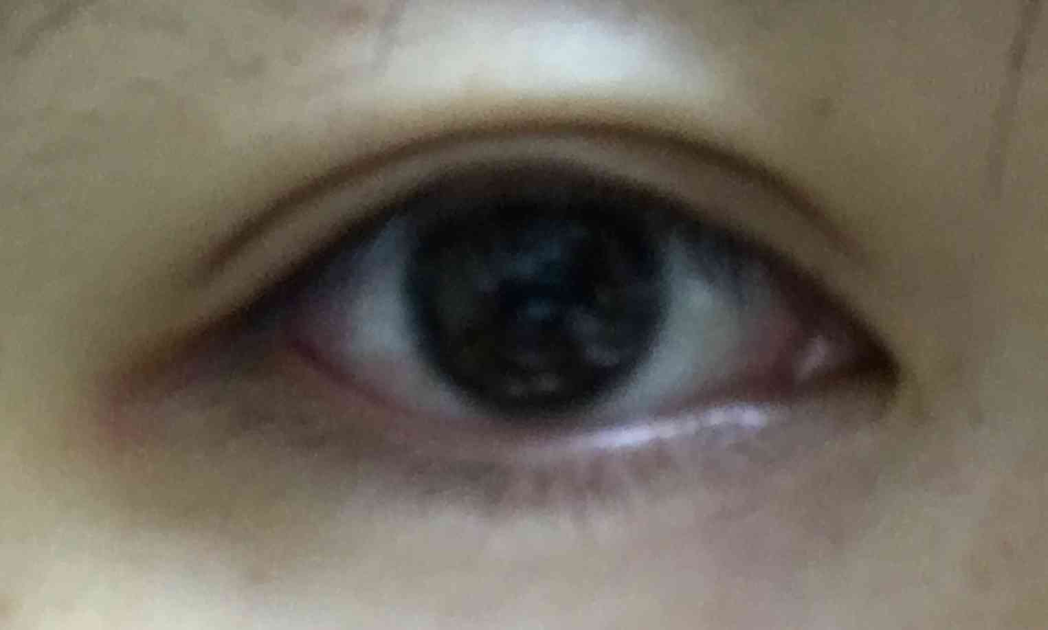 平行二重の目ってそんなにいいですか?