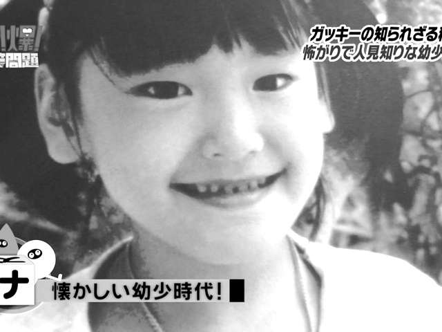 平行二重の目ってそんなにいいですか?