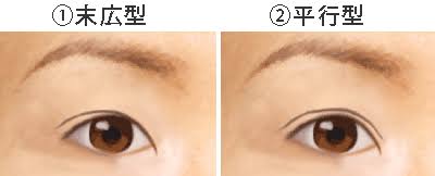 平行二重の目ってそんなにいいですか ガールズちゃんねる Girls Channel