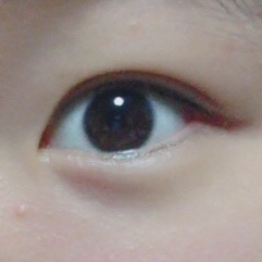 平行二重の目ってそんなにいいですか?