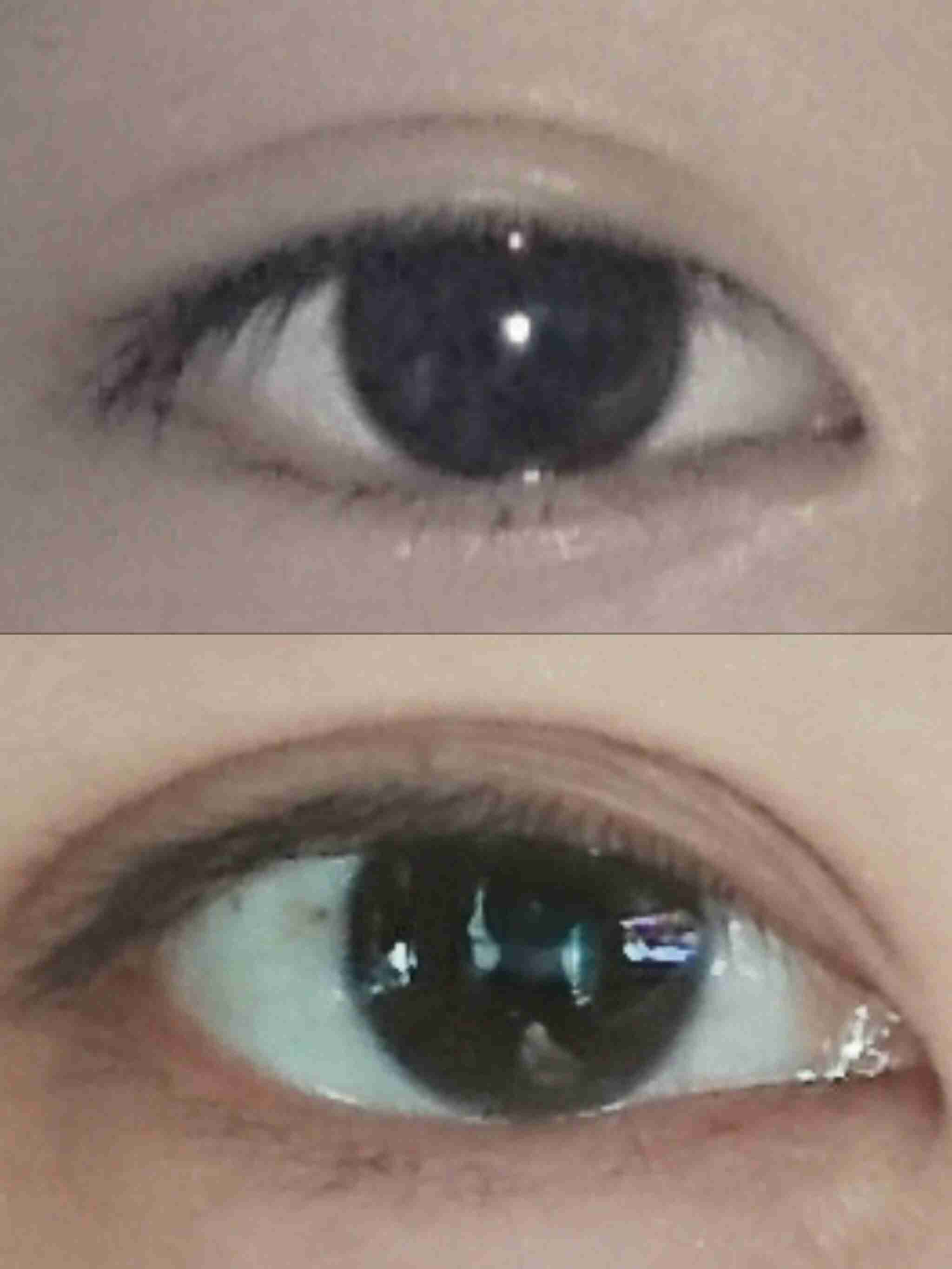 平行二重の目ってそんなにいいですか?