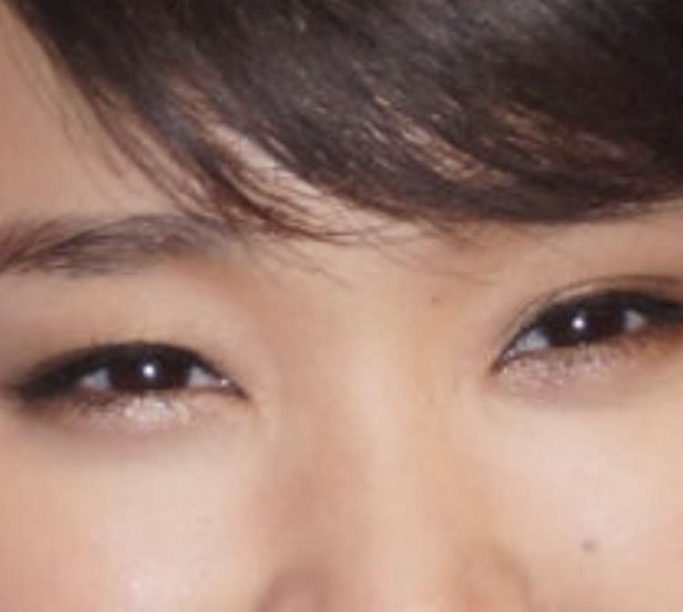 平行二重の目ってそんなにいいですか?