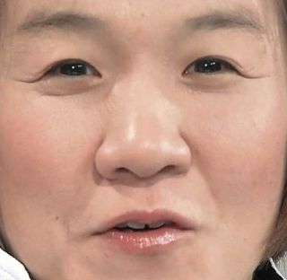 平行二重の目ってそんなにいいですか?