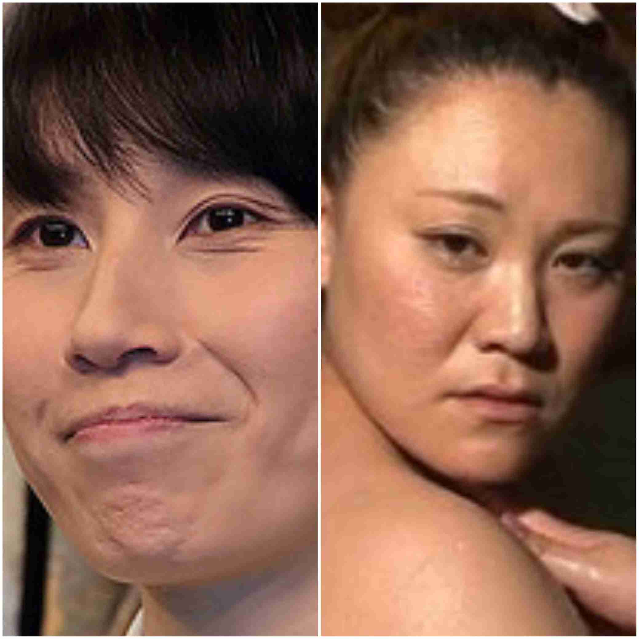 平行二重の目ってそんなにいいですか?