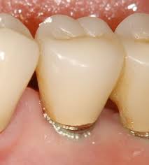 使ってるハミガキ粉