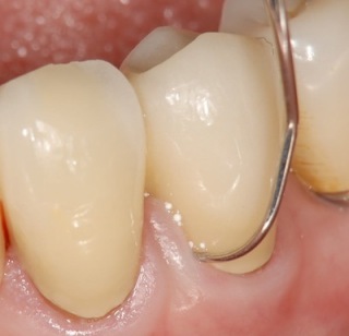 使ってるハミガキ粉