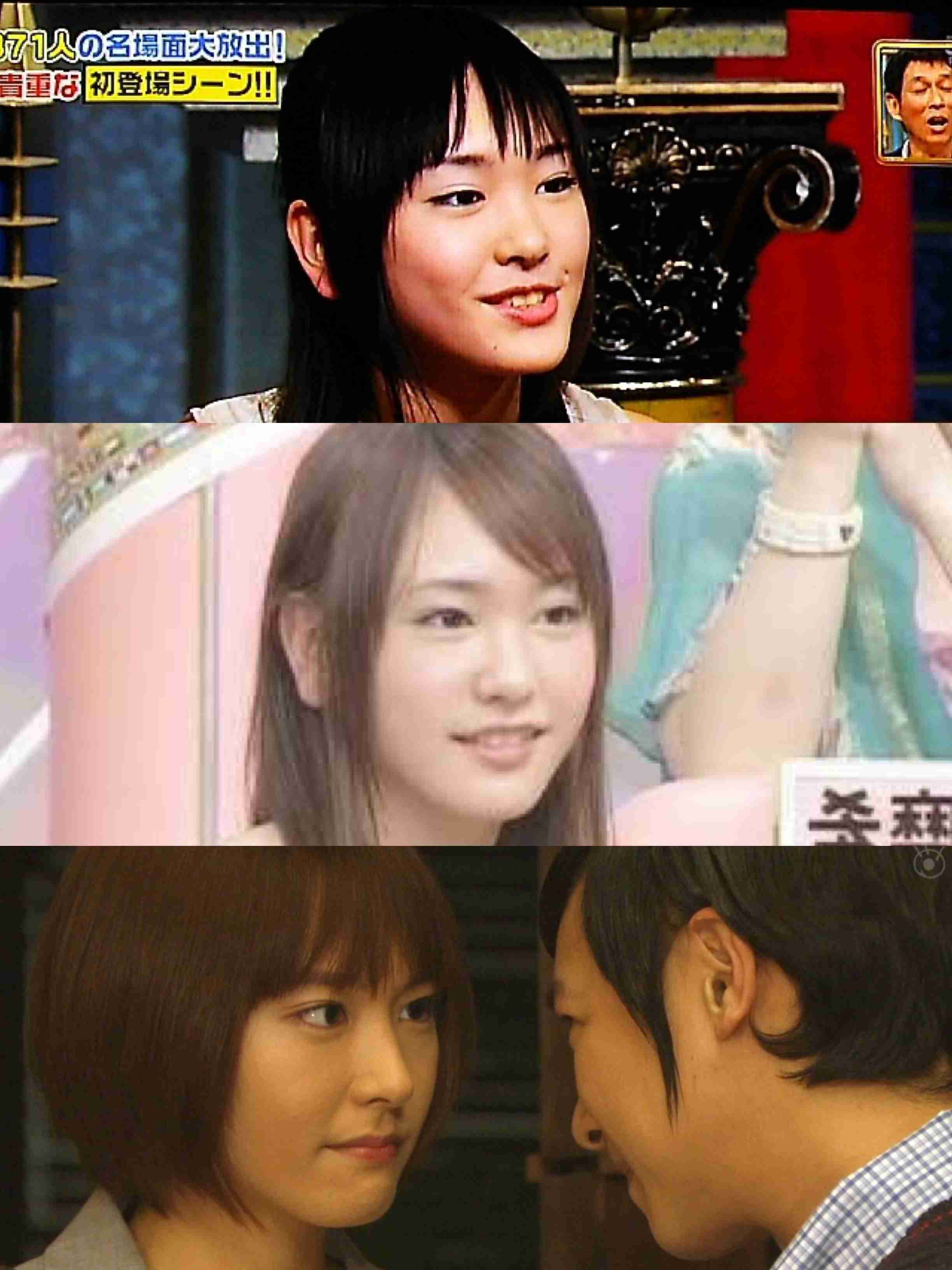 整形前の顔が好きだった芸能人