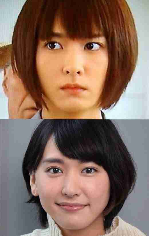 整形前の顔が好きだった芸能人