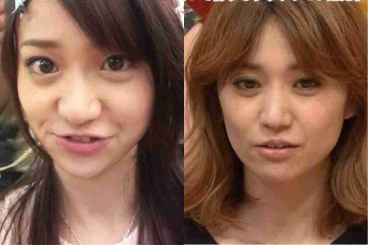 整形前の顔が好きだった芸能人