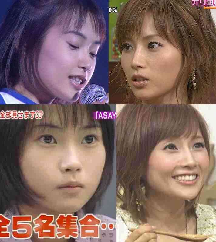 整形前の顔が好きだった芸能人