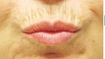 AKB48小嶋陽菜、小嶋真子&小嶋菜月と“可愛いすぎる3姉妹ショット“披露