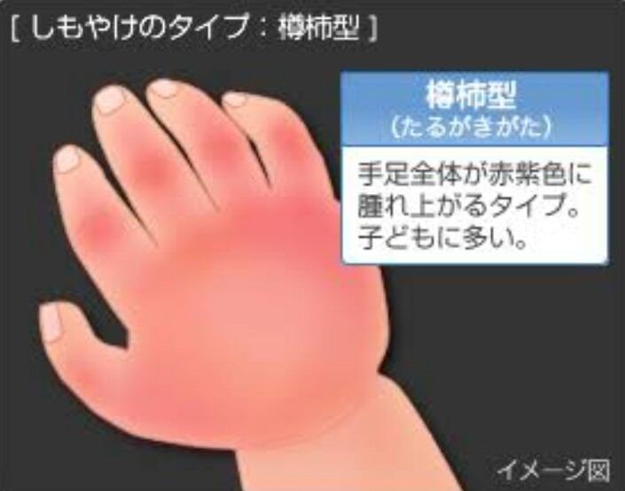 冬の赤ちゃんあるある♡