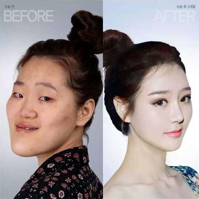 整形が成功する人と失敗する人の違い
