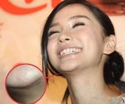 アゴに違和感を感じる芸能人