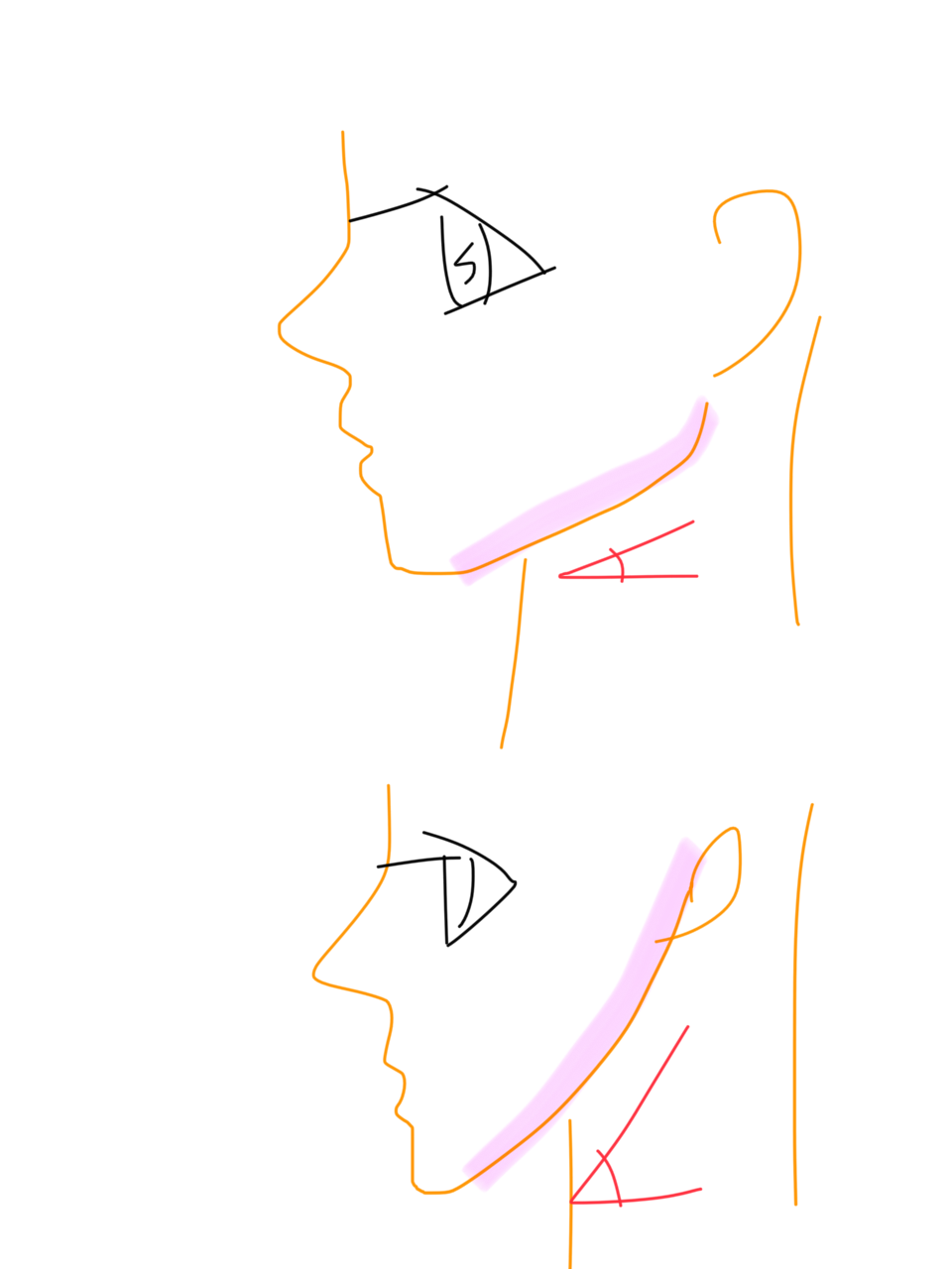 アゴに違和感を感じる芸能人