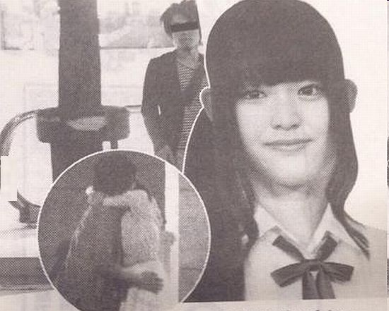 アゴに違和感を感じる芸能人