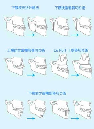 歯列矯正中の方、興味ある方語りましょう‼︎