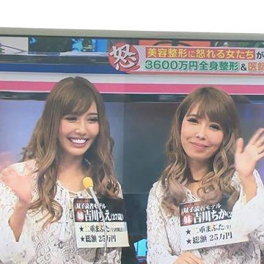 整形公表の双子モデル・吉川ちえ&ちか「小悪魔ageha」卒業を発表 決意の理由は?