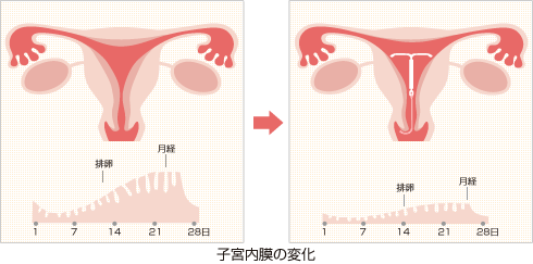 生理の時の悩み