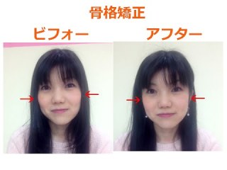 骨格がブス（涙）