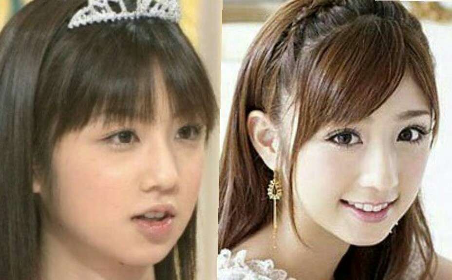 小倉優子などの“不倫サレ妻”に高須克弥院長「野生動物系男子は家庭で飼えないよ!」