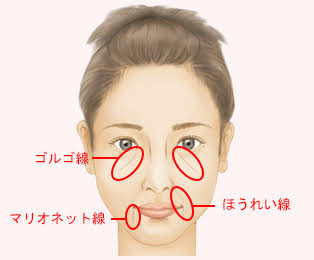 はじめてのゴルゴ線