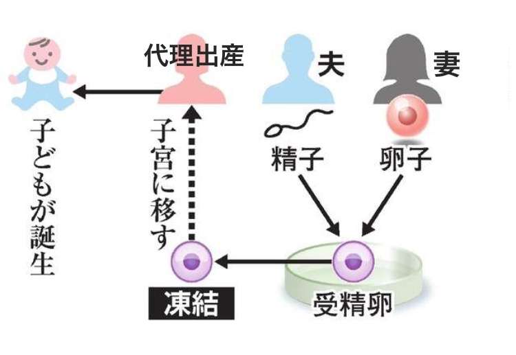 匿名の第三者の卵子で女児誕生　国内初の体外受精