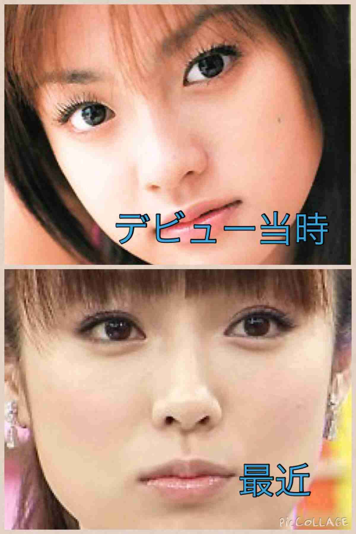整形成功したと思う芸能人