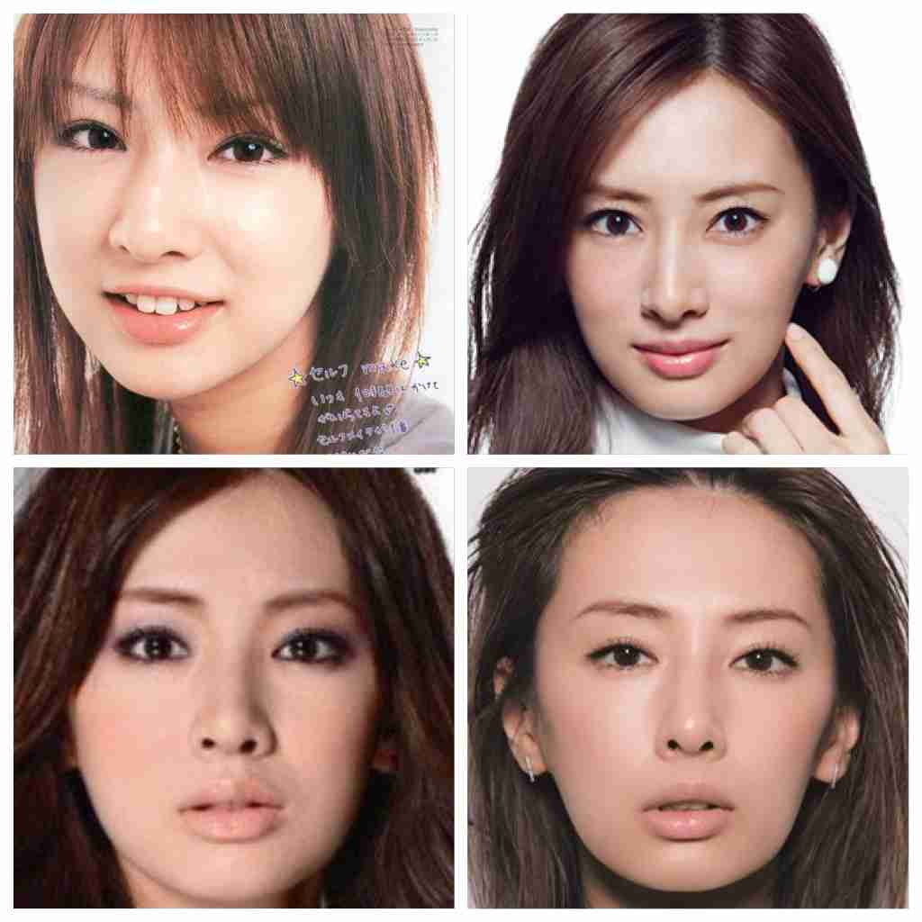 整形成功したと思う芸能人 ガールズちゃんねる Girls Channel