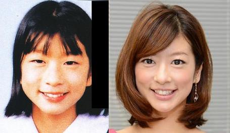 整形成功したと思う芸能人