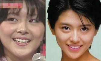 整形成功したと思う芸能人