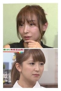 ぱっちり目が魅力!だけど違和感を感じちゃう女性芸能人ランキング