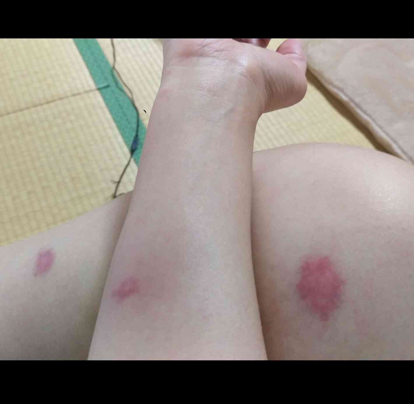 蚊に悩まされている人。