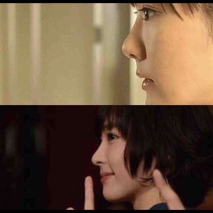 整形した人！  その後バレたりしましたか？