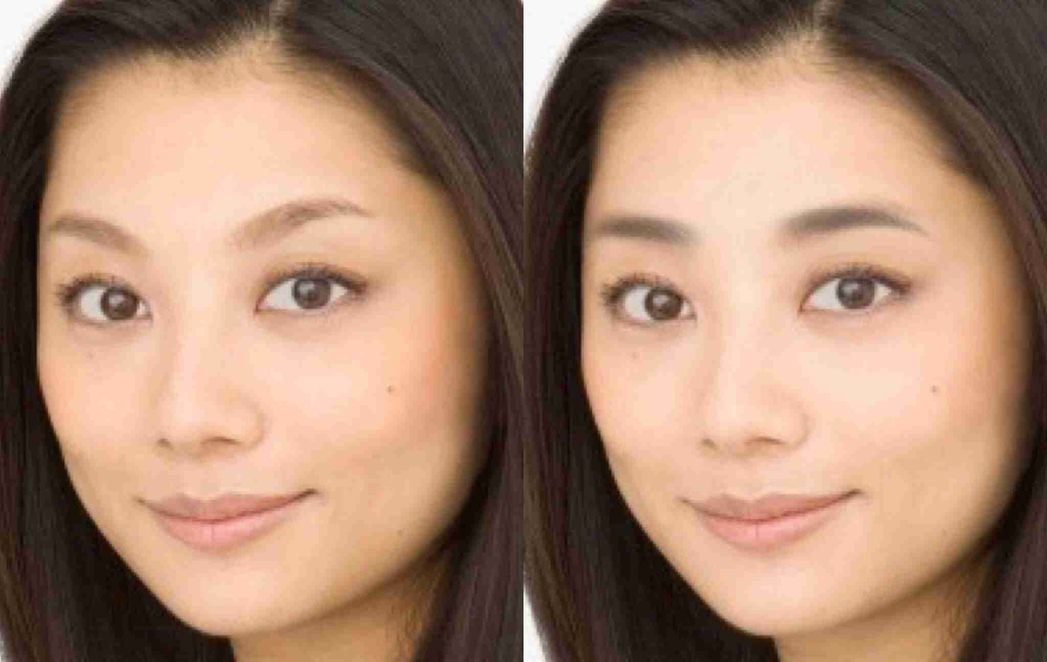 整形した人！  その後バレたりしましたか？