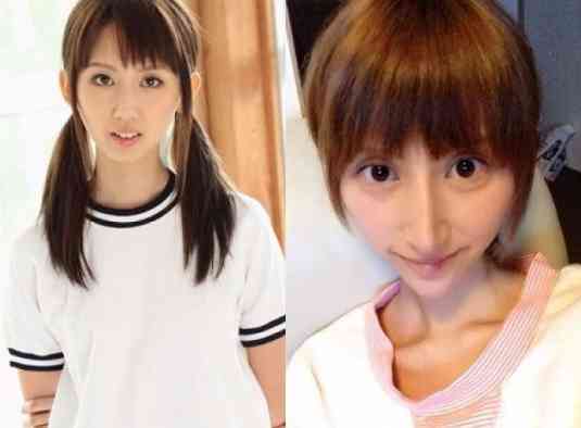 整形した人！  その後バレたりしましたか？