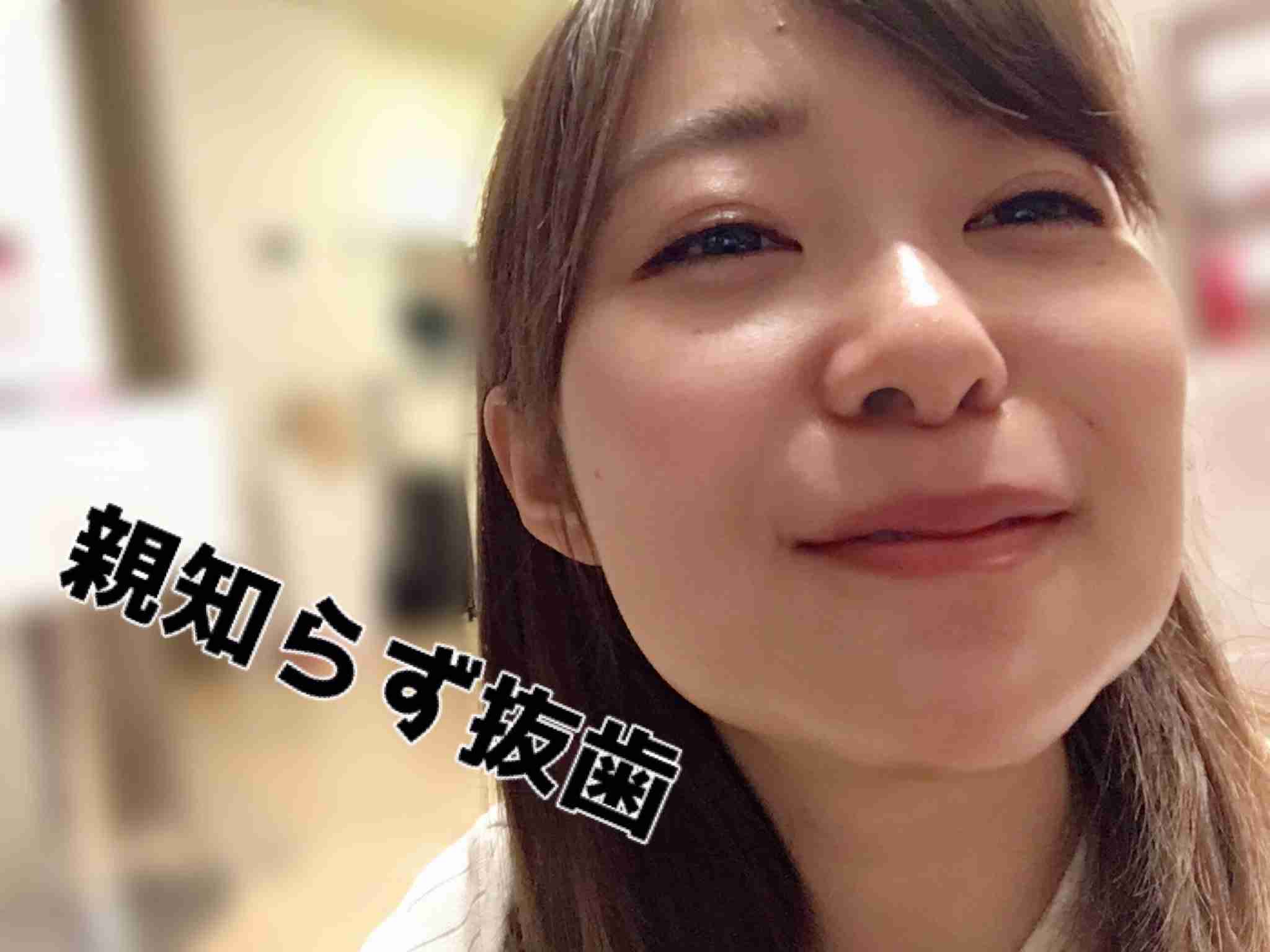指原莉乃 体調不良で握手会中止 前日に親知らず4本抜歯