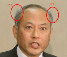 鉢張りさん大集合