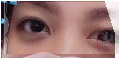 ざわちん、嵐・相葉雅紀風ものまねメイク公開「完成度高すぎる」「激似」と絶賛＆歓喜の声