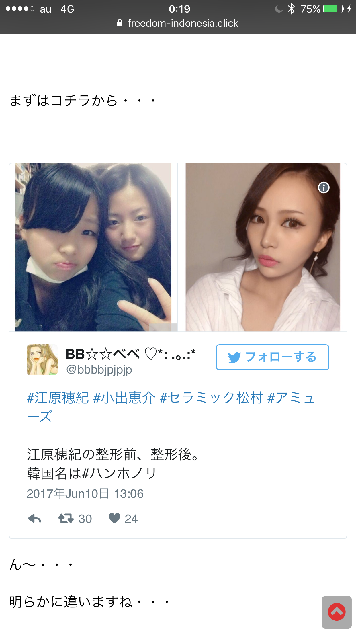 新垣結衣、高所恐怖症だった　コードブルー撮影でヘリ乗るも「汗びっちょり」