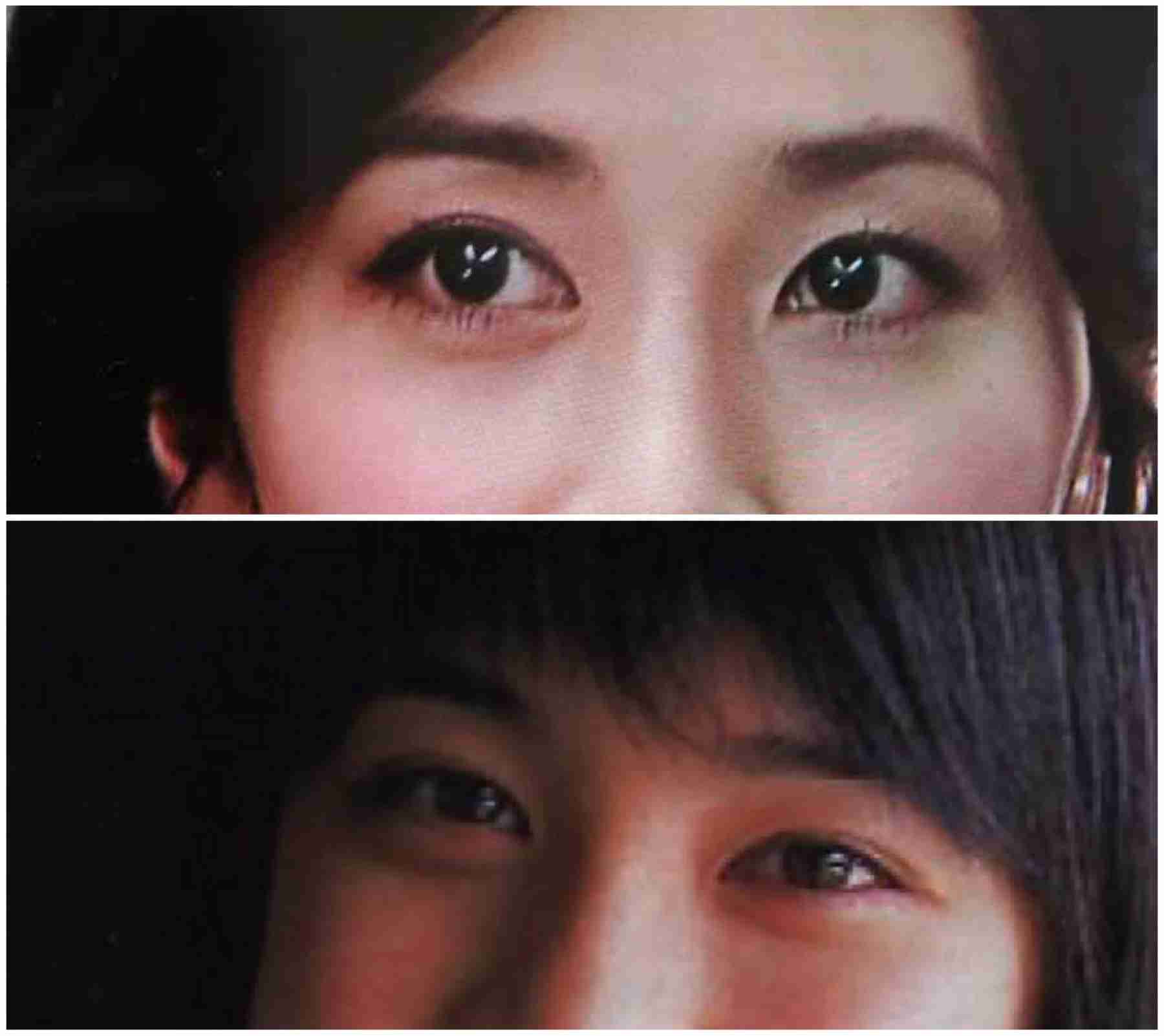 目頭切開してる芸能人 ガールズちゃんねる Girls Channel