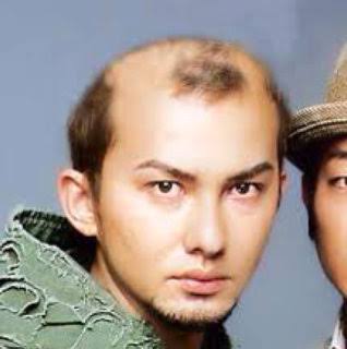 ライブで女性ファン悲鳴 ミスチル桜井和寿 頭髪変化 の衝撃 頭頂部の髪を全部前に持ってきてスプレーでガチガチに ガールズちゃんねる Girls Channel