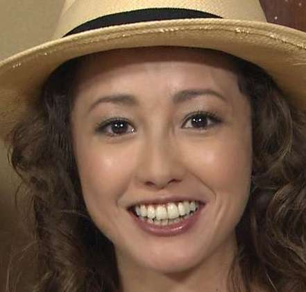 口元が残念な芸能人