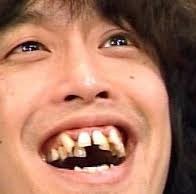 口元が残念な芸能人