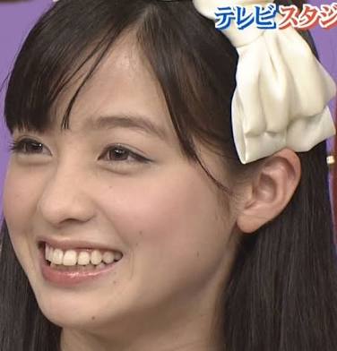口元が残念な芸能人