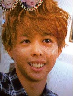 口元が残念な芸能人