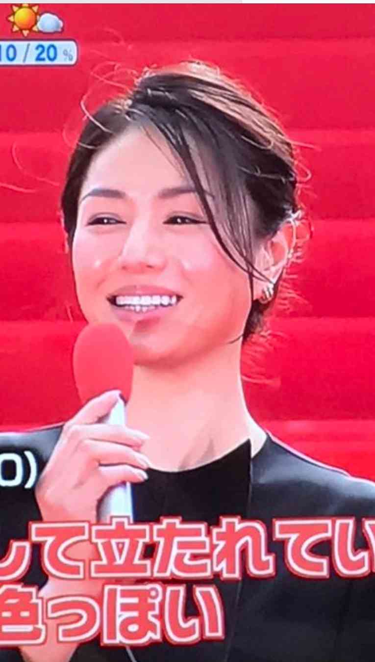 口元が残念な芸能人