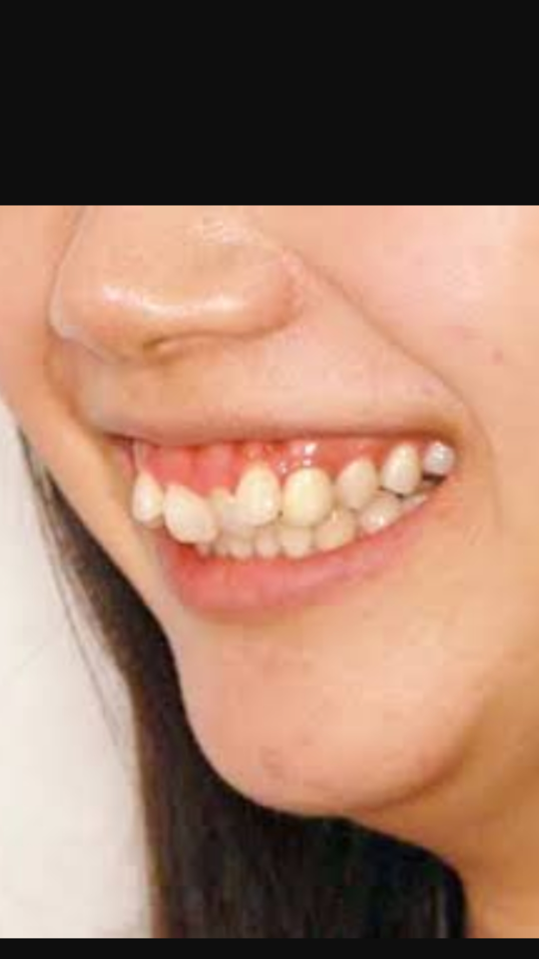 下品な顔ってどんな顔？