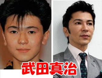 マジで整形やり過ぎてる!と思う芸能人は?