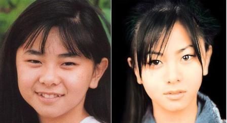 マジで整形やり過ぎてる!と思う芸能人は?